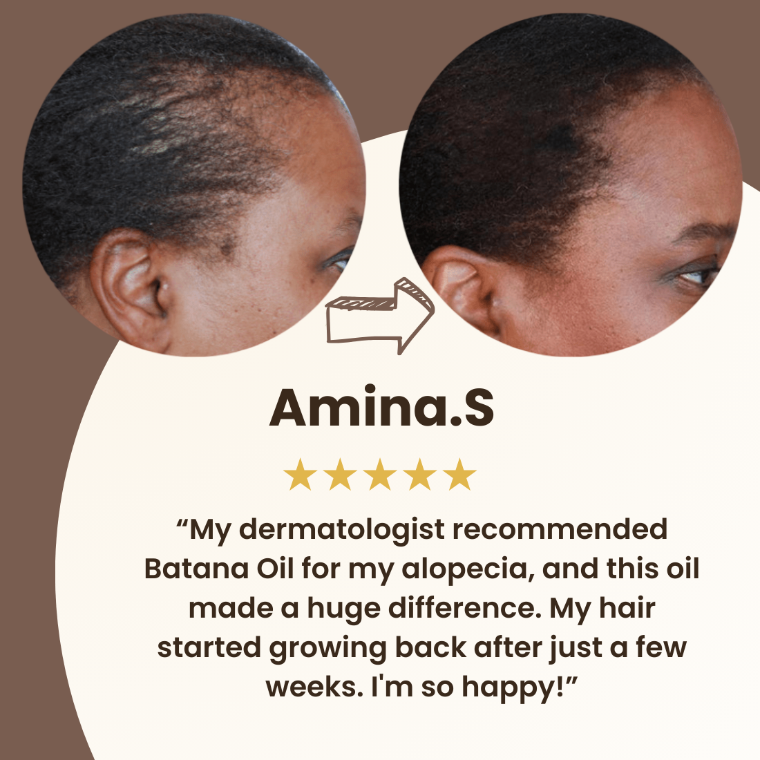 Batana Natural Hair Growth Oil