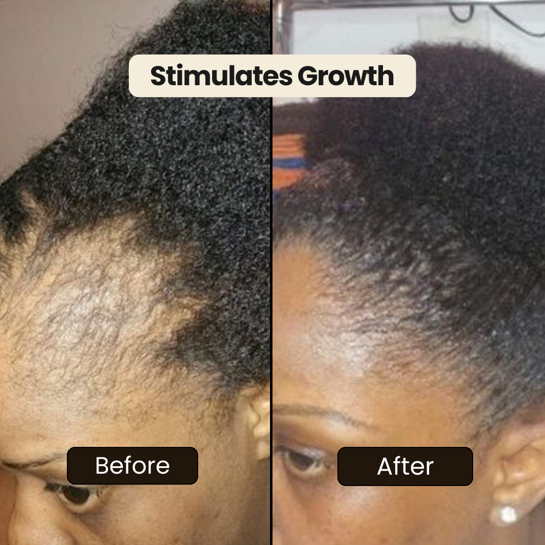 Batana Natural Hair Growth Oil