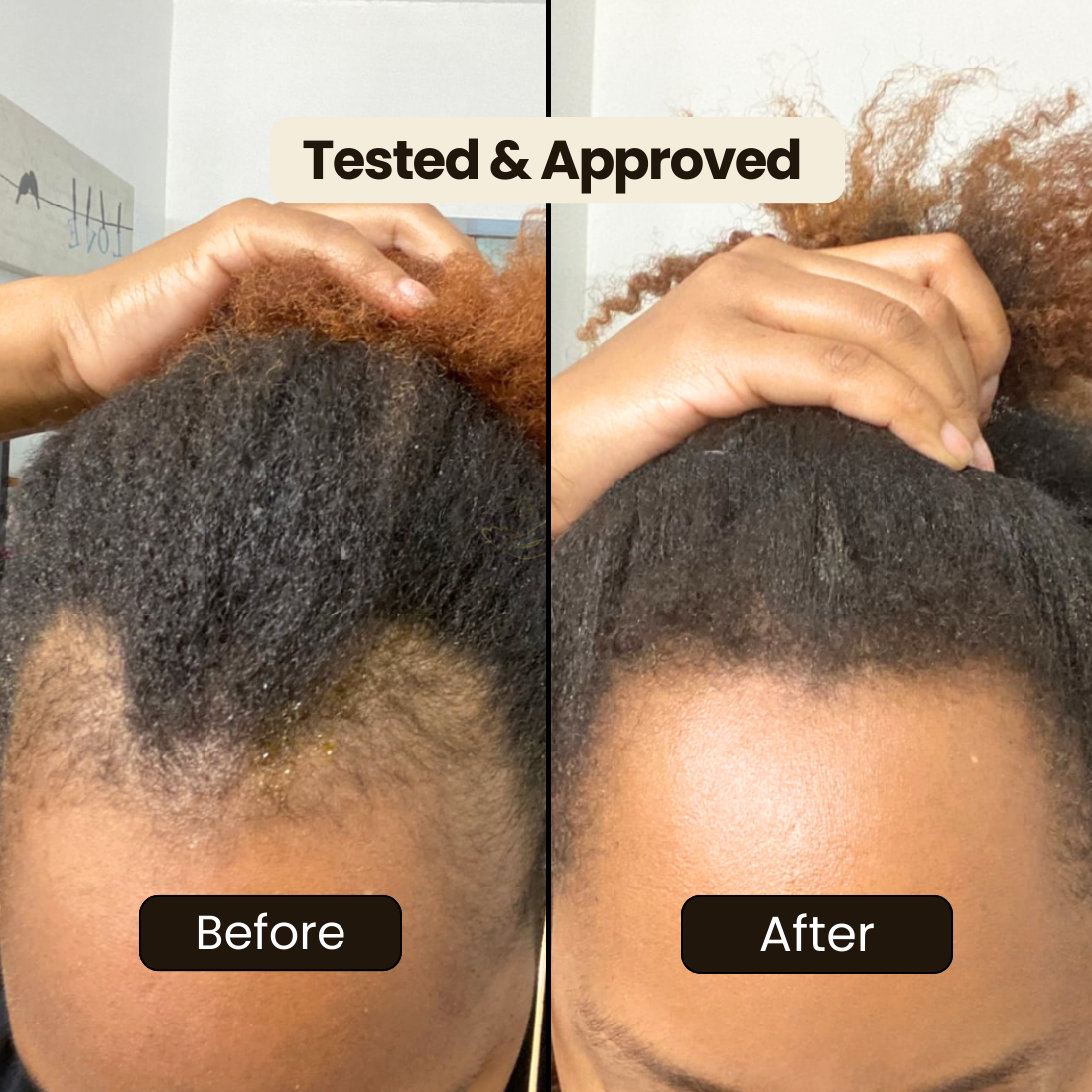 Batana Natural Hair Growth Oil